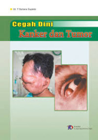 Image of Cegah dini kangker dan tumor